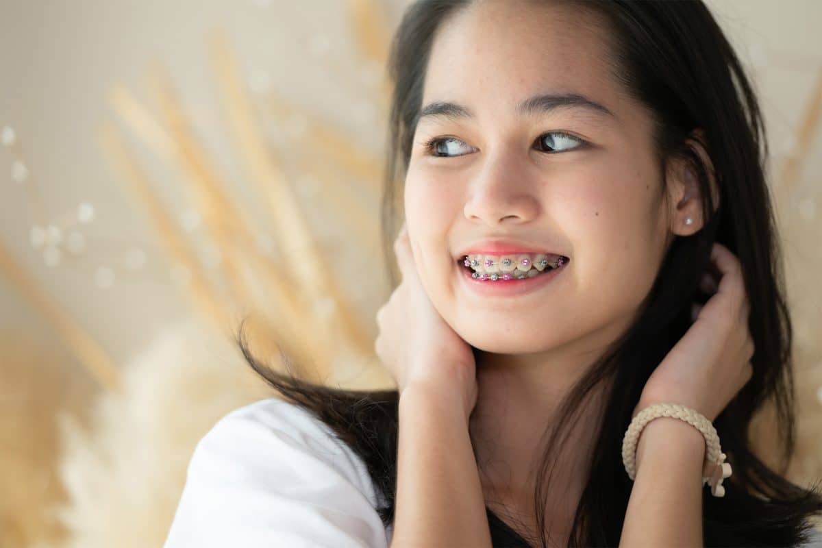 traditional-brackets-self-ligating-brackets-or-clear-aligners-which-is-best-for-you-01