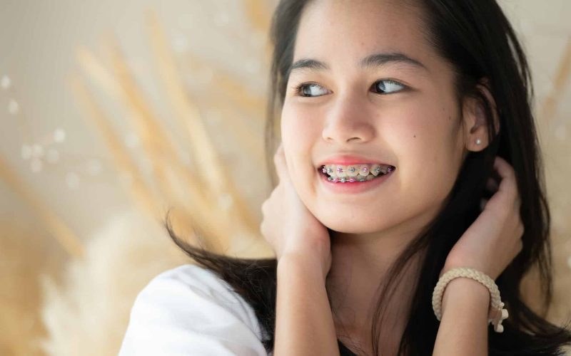 traditional-brackets-self-ligating-brackets-or-clear-aligners-which-is-best-for-you-01